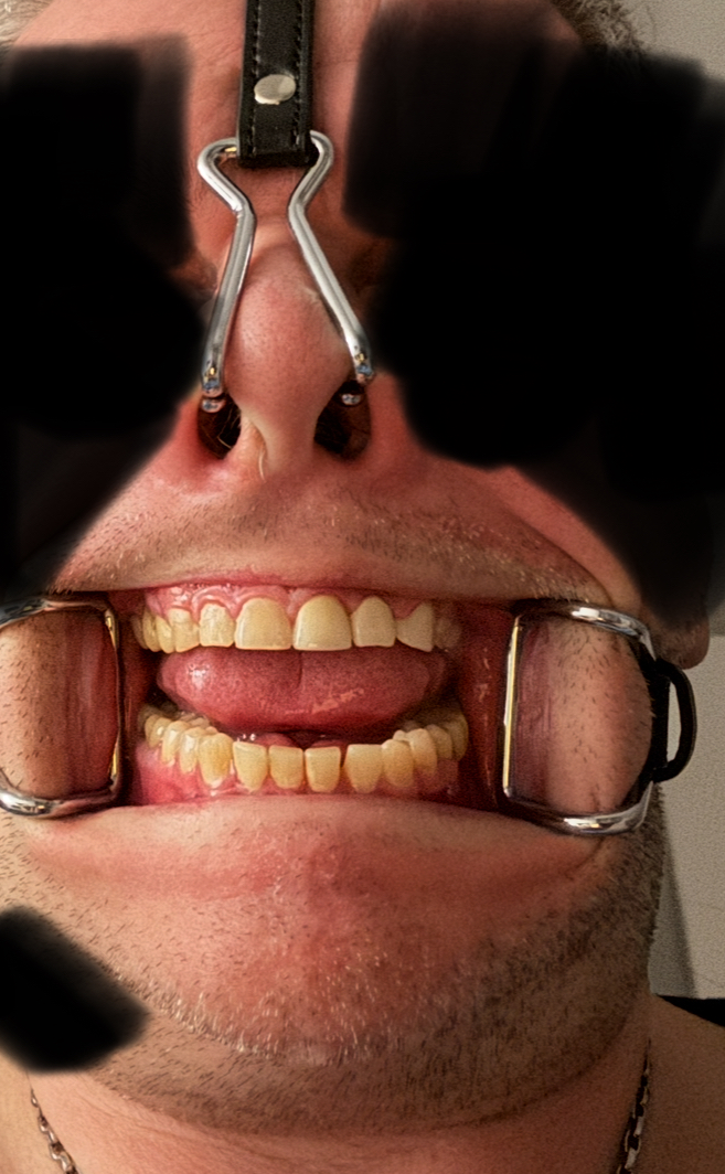 Bin für fast alles Offen